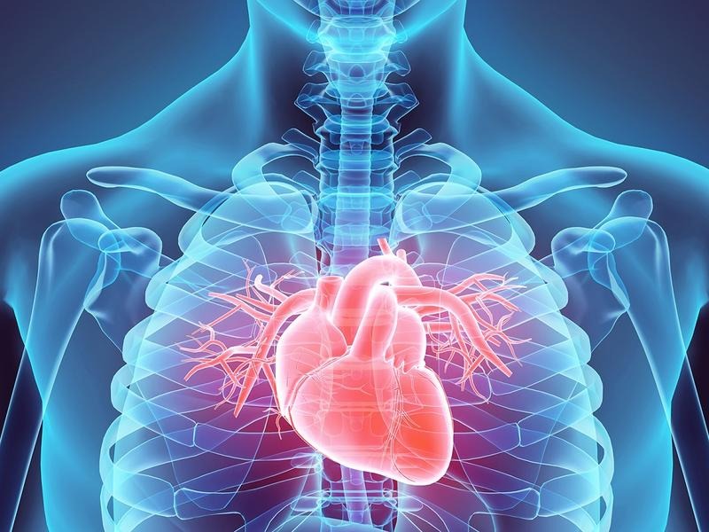 cardiology product supplies Cameroon