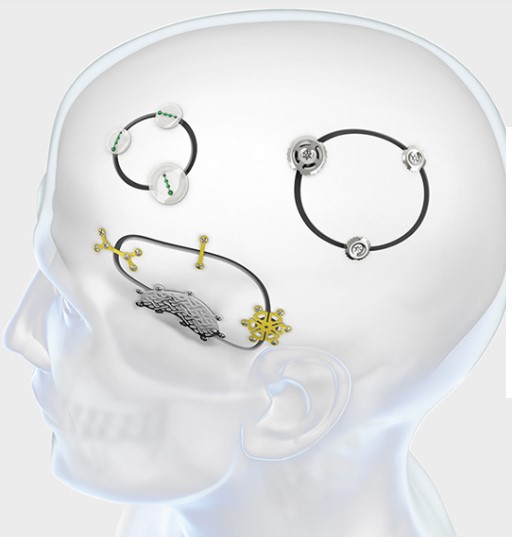 Neuro-Plating-System supplies Cameroon